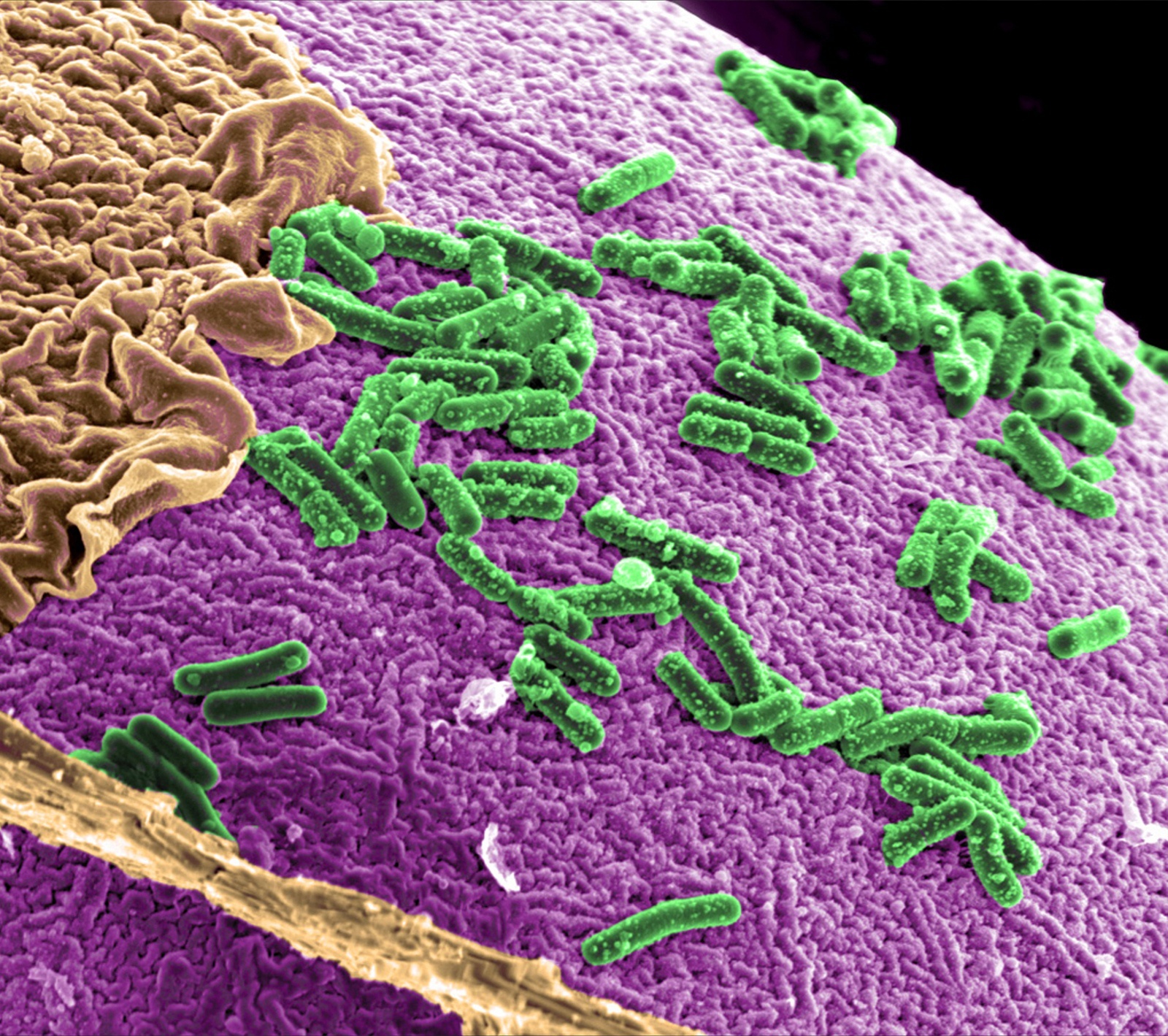 ¿Qué es la microbiota intestinal?